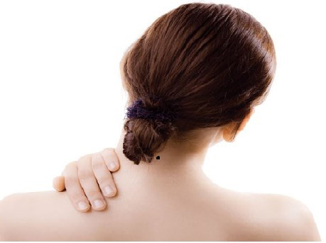 Giải mã ý nghĩa của nốt ruồi sau gáy Giải mã ý nghĩa của nốt ruồi sau gáy