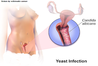sakit perut saat menstruasi sakit perut saat menstruasi