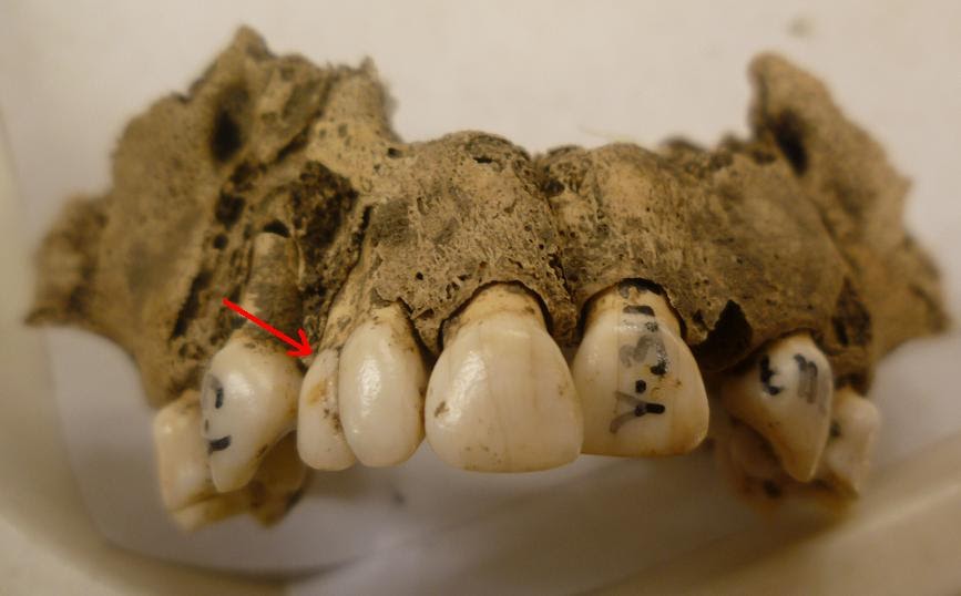 Teething problems: When teeth go wrong!