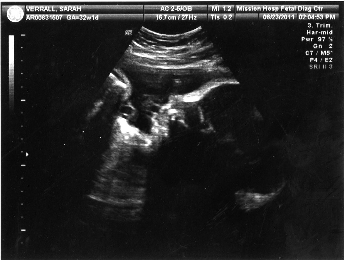 project-baby-32-weeks