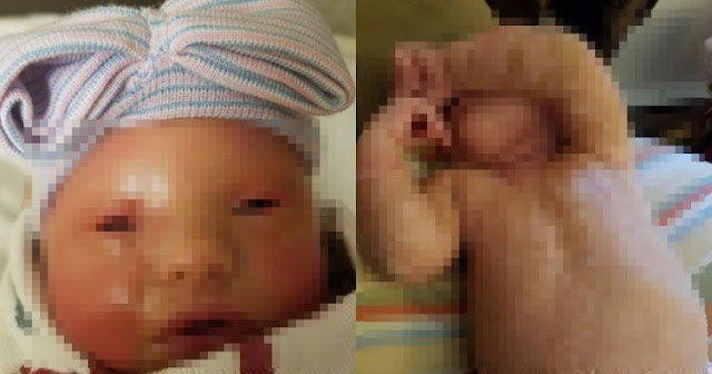 Fakta Viral! Bayi yang Dimandikan Dengan Pemutih Pakaian Oleh Ibu Kandungnya