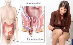 obat sipilis termanjur www.griyadenature.tk