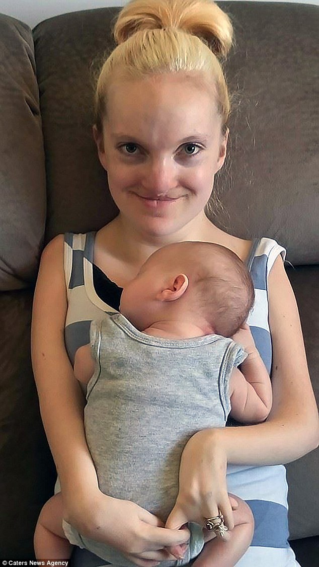 Woman With No Muscles In Her Arms and Legs Gives Birth To A Healthy Baby