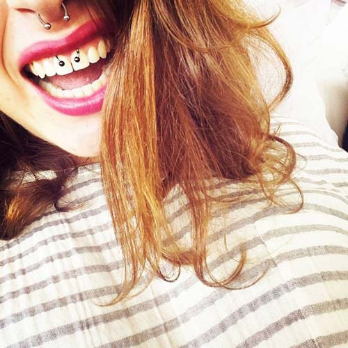 smiley piercing taktırma smiley piercing taktırma