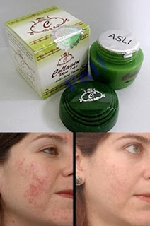 Collagen Anti Acne Cream asli/murah/original/supplier kosmetik