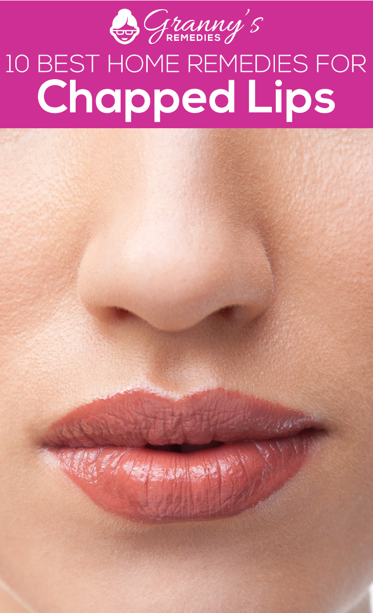 10 Best Home Remedies for Chapped Lips | Granny's Remedies