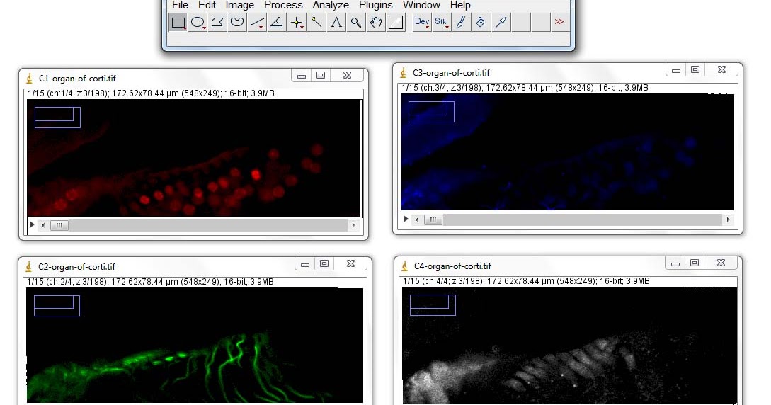 My imageJ เมนู Image with ImageJ [ตอนที่ 11] Color เครื่องมือจัดการภาพสี การแยกช่องสัญญาณ Color