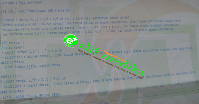 Contoh hasil USG Transrectal Contoh hasil USG Transrectal