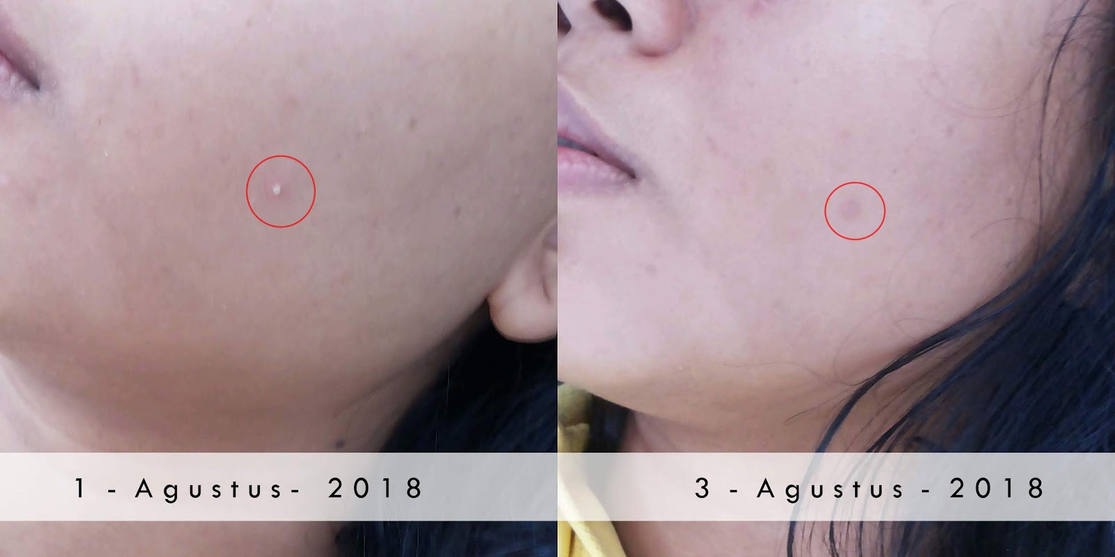 naruko-tea-tre-shine-control-blemish-clear-night-gelly review-naruko-tea-tree-night-gelly