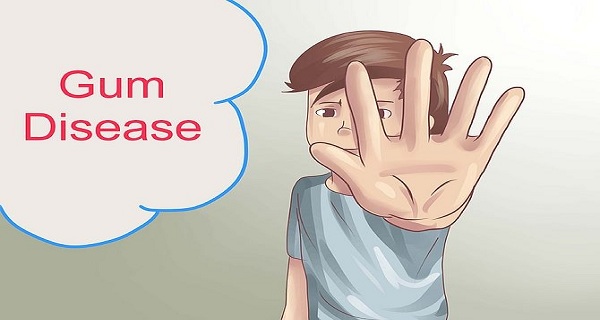 OLVIDARSE DE LOS DENTISTAS! ESTE INGREDIENTE SIMPLE PUEDE TRATAR A SU SANGRADO DE LAS ENCÍAS, RETRACCIÓN DE LAS ENCÍAS Y LOS DIENTES FLOJOS OLVIDARSE DE LOS DENTISTAS! ESTE INGREDIENTE SIMPLE PUEDE TRATAR A SU SANGRADO DE LAS ENCÍAS, RETRACCIÓN DE LAS ENCÍAS Y LOS DIENTES FLOJOS