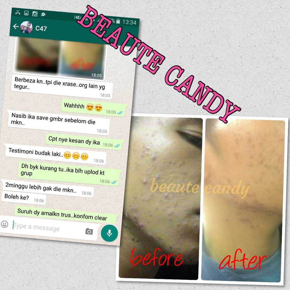 BEAUTE CANDY Solehah Beauty Centre BEAUTE CANDY Solehah Beauty Centre
