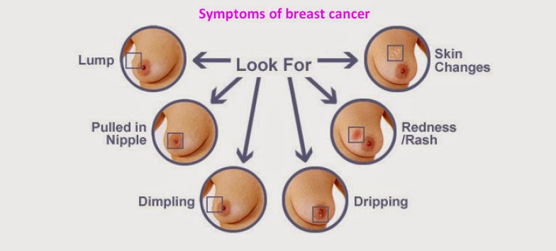 Understanding Breast Cancer Prognosis and Life