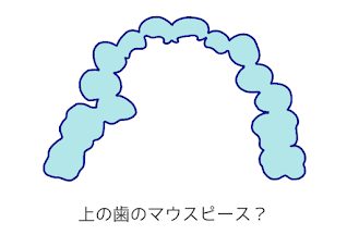 抜歯ワイヤー矯正患者が思う「マウスピース矯正」について