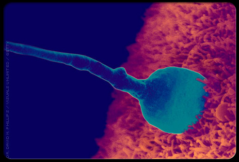 Acidic sperm burning Acidic sperm burning