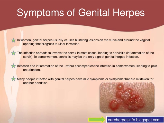 Genital Herpes Sexually Transmitted Diseases
