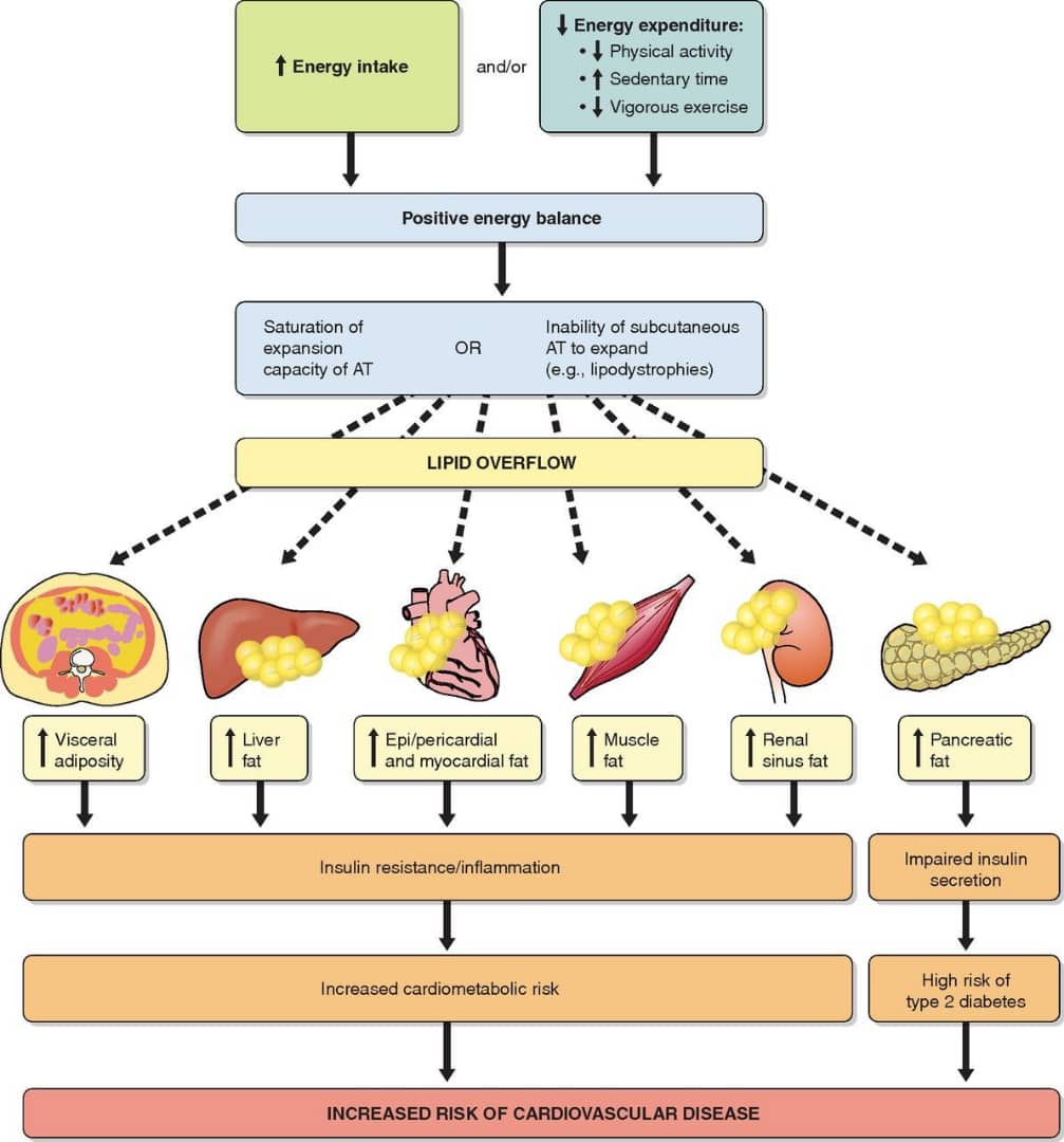 obesity visceral pathophysiology adipose insulin t2d lipid pankreas kesan abdominal physrev