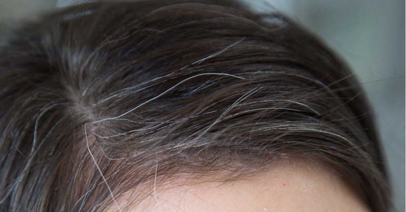 Home Remedies To Reverse Grey Hair Naturally Healthy Central Blog
