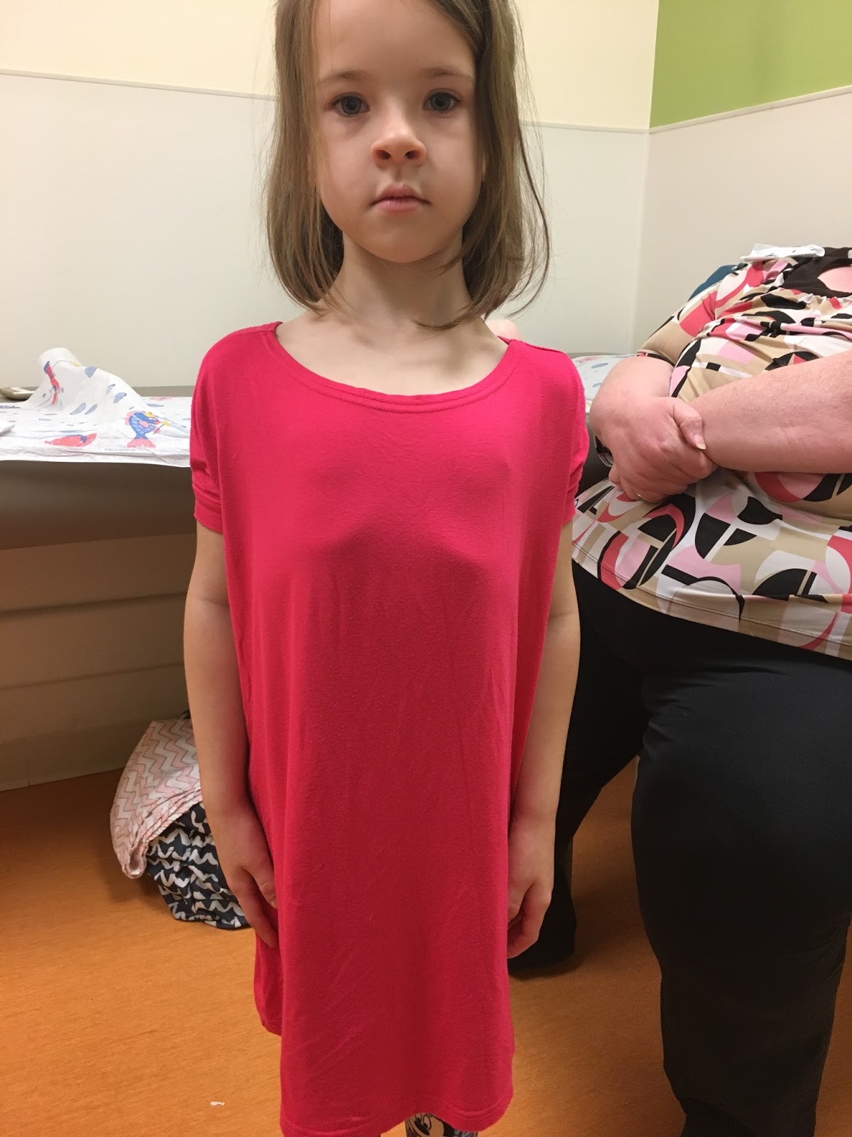 cleidocranial dysplasia