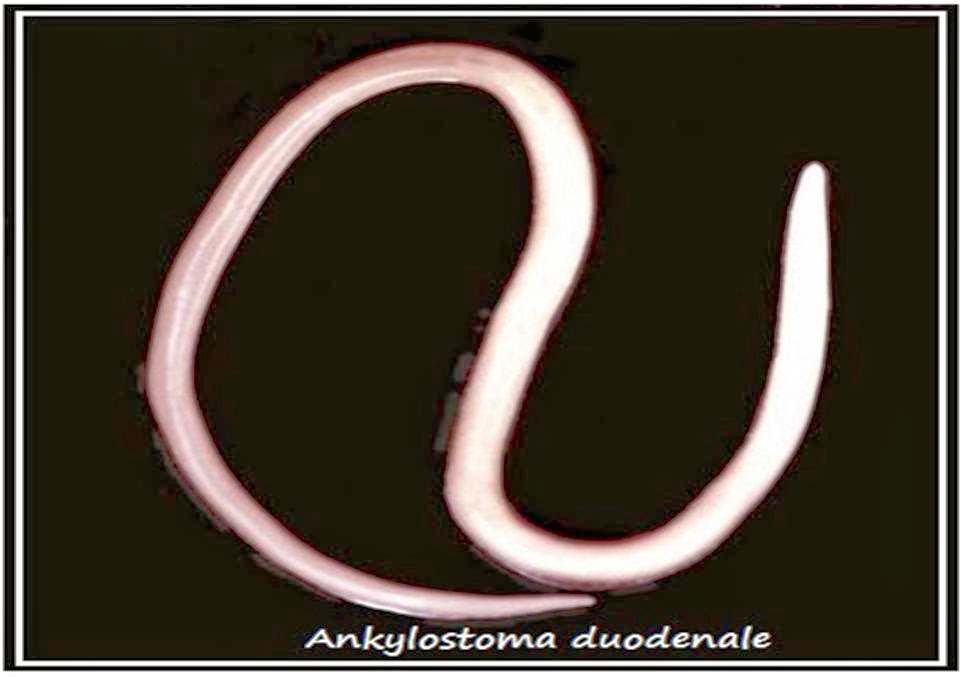Длинные черви у кошек. Ленточный червь широкий лентец. Белые червячки острицы. Власоглав паразиты млекопитающих. Паразиты у кошек гельминты.