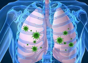 निमोनिया के लक्षण और घरेलू उपचार, Pneumonia symptoms and home remedies निमोनिया के लक्षण और घरेलू उपचार, Pneumonia symptoms and home remedies