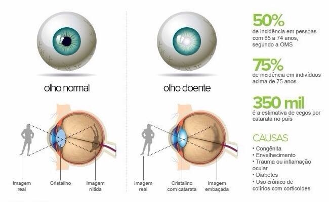 cegueira diabetes mellitus