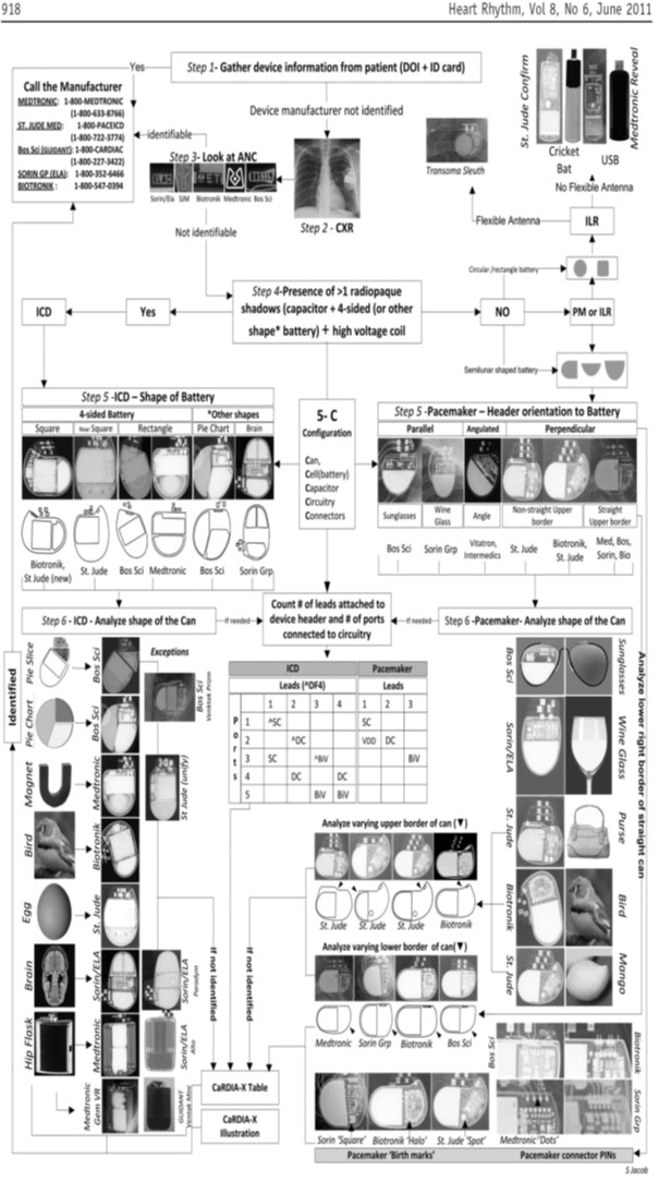 Pedi cardiology how to identify pacemaker 