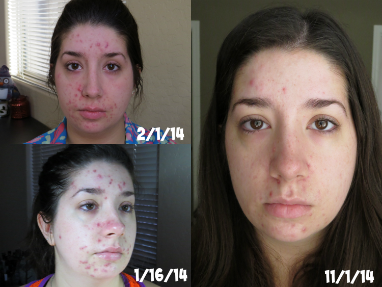 Proactiv Complexion Perfecting Hydrator Online Discount Shop For Electronics Apparel Toys Books Games Computers Shoes Jewelry Watches Baby Products Sports Outdoors Office Products Bed Bath Furniture Tools Hardware Automotive