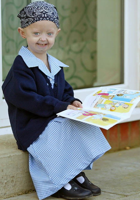 Hutchinson Gilford Progeria Syndrome Christine Odonnell