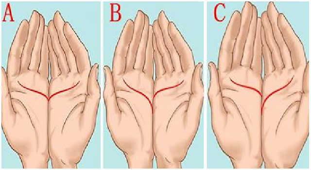 Menarik, Begini Garis Tangan Orang yang Bakal Kaya dan