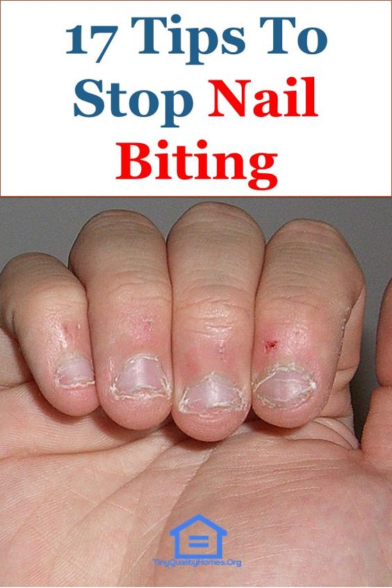 How To Stop Nail Biting note in beauty