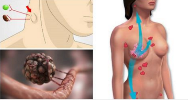 UN SIMPLE VISTAZO A SU CUELLO PUEDE REVELAR SI USTED SUFRE DE ALGO DE MENOR IMPORTANCIA COMO LAS BACTERIAS, O INCLUSO CÁNCER! UN SIMPLE VISTAZO A SU CUELLO PUEDE REVELAR SI USTED SUFRE DE ALGO DE MENOR IMPORTANCIA COMO LAS BACTERIAS, O INCLUSO CÁNCER!