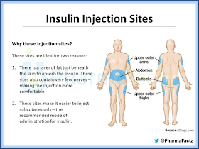 amudu: Insulin Injection Sites