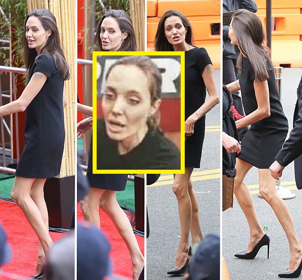 Angelina Jolie está al borde de la muerte por esta terrible enfermedad - Imagen 3