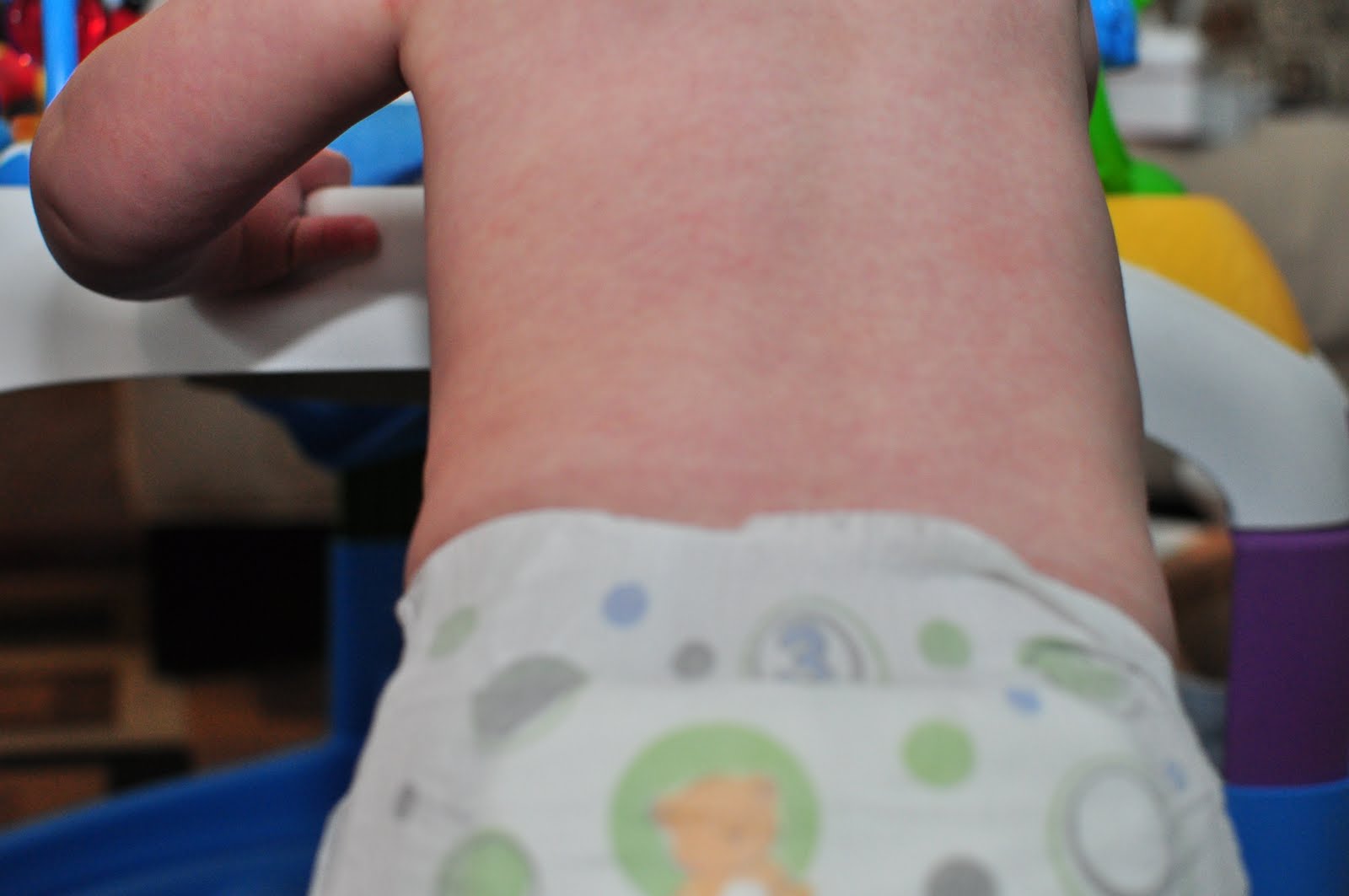 Roseola (Sixth Disease) Symptoms, Treatment & Pictures