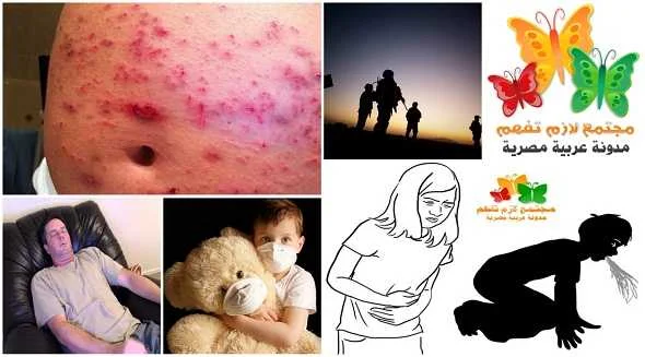 top-5-strangest-diseases-without-known-cause-اغرب-5-امراض-بدون-سبب-معروف