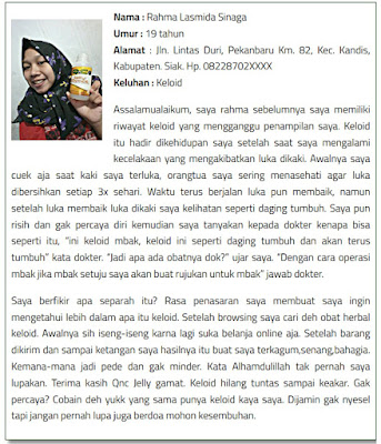Cara Menghilangkan Skin Tag Atau Daging Tumbuh Di Kulit Leher Cara Menghilangkan Skin Tag Atau Daging Tumbuh Di Kulit Leher