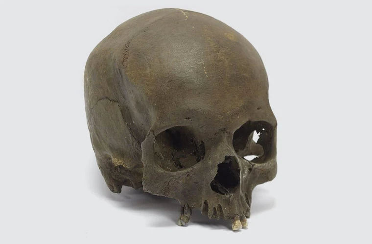 In England, they found the skull of a ritual murder