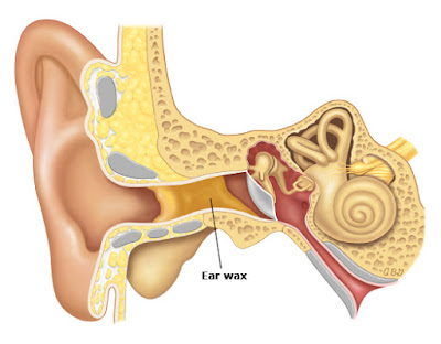 Wax In Ear