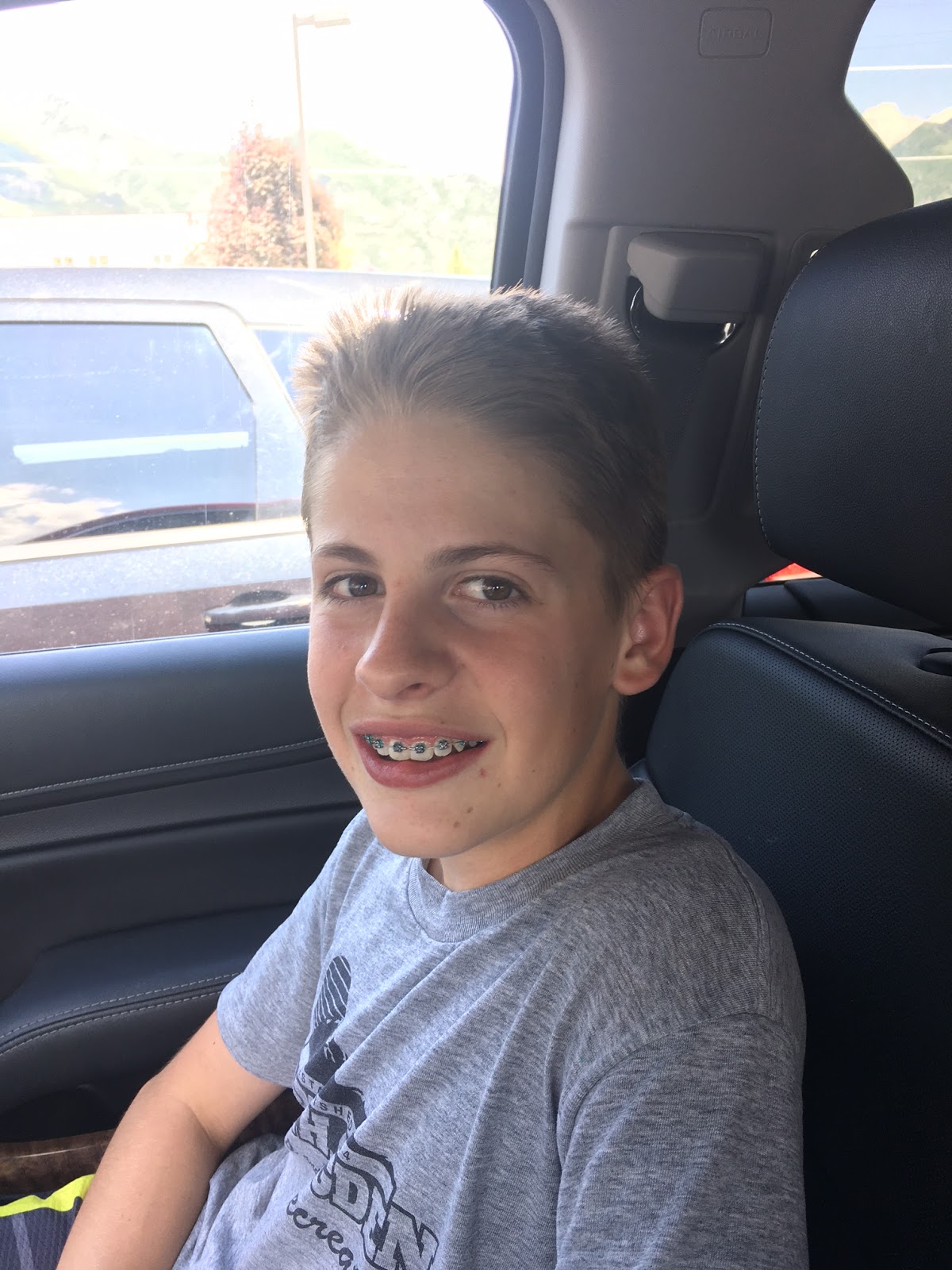 The Ropelato Family This Cute Boy Got Braces