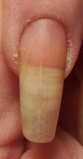 I have one fingernail that will not stop splitting down ...