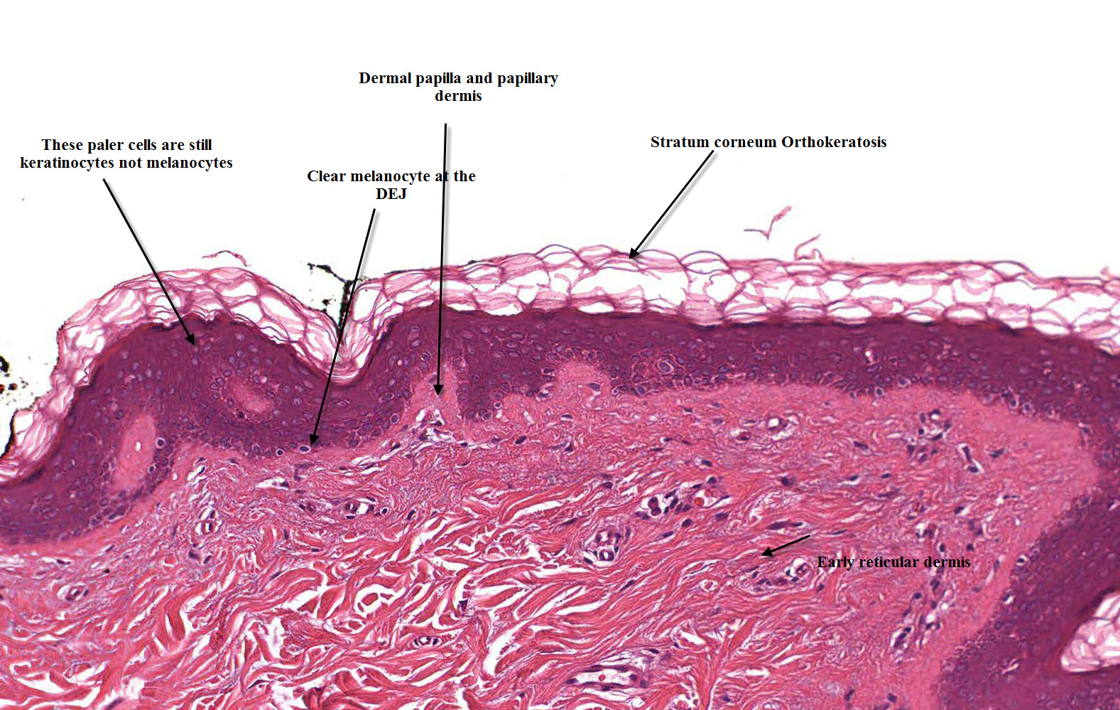 Melanocyte Pathology - Homepage | Mooi