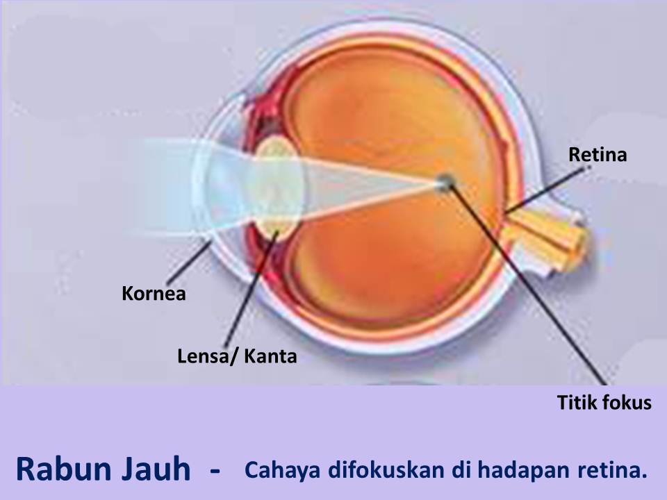 Mengenal Rabun Jauh, Rabun Dekat, Rabun Tua, dan Rabun Senja - Media ...