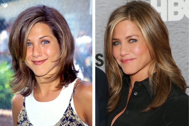 Famous for Plastic Surgery: Jennifer Aniston Plastic Surgery Eyelid, Facelift Before and After