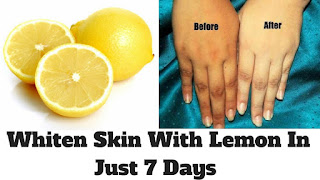 aclarar piel con limón
