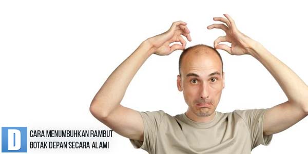 Cara Menumbuhkan Rambut Botak Depan Secara Alami Cara Menumbuhkan Rambut Botak Depan Secara Alami