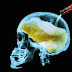 These Are Alcohol's Effects On Your Brain