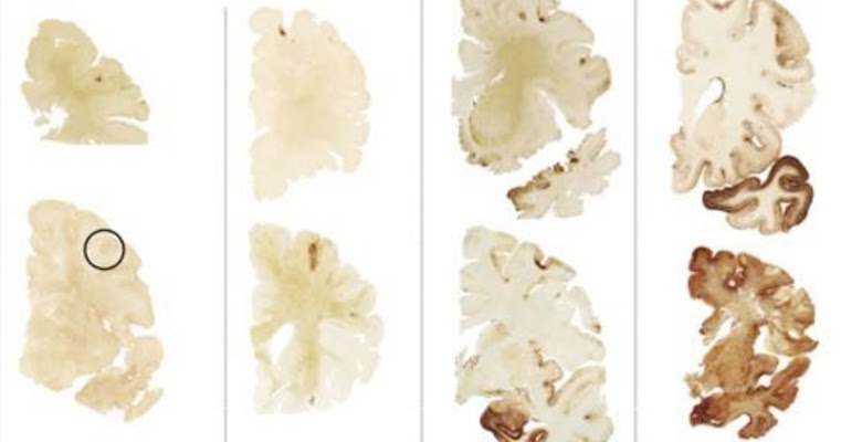 What Exactly is CTE?