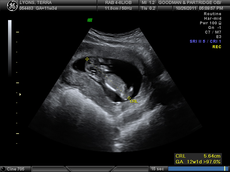 The Lyons Family: 14 Weeks & 4 Days Pregnant!!