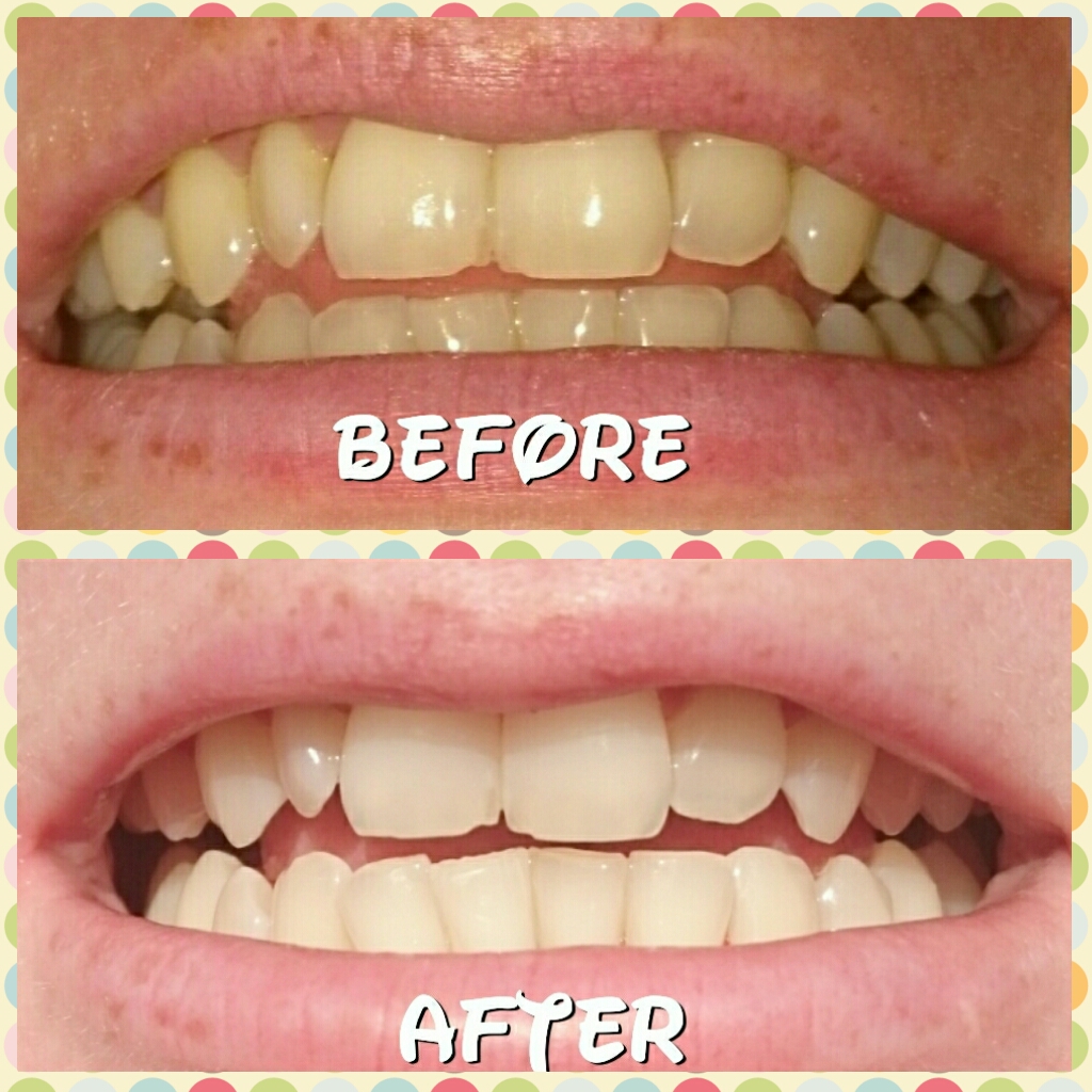beverly hills perfect white black toothpaste and mouthwash