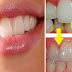 Enlevez tout le tartre de vos dents grâce à ce mélange naturel ! C’est rapide et facile !